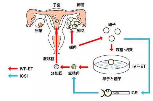 广州试管婴儿选择男女_三代试管筛选_试管婴儿医保报销吗-聚光灯下的首个试管